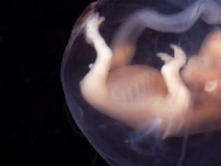 Φωτογραφία για Καλλιεργήθηκε στο εργαστήριο για πρώτη φορά ένα ανθρώπινο έμβρυο δύο εβδομάδων