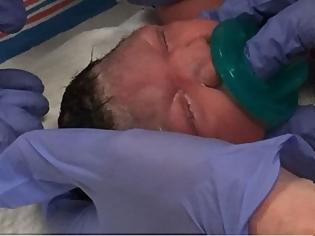 Φωτογραφία για Μωρό με μικροκεφαλία λόγω του ιού Ζίκα γεννήθηκε στο Νιου Τζέρσι