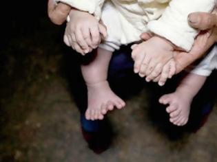 Φωτογραφία για Μωρό γεννήθηκε με 31 δάχτυλα [photos]
