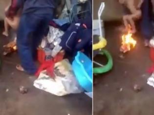 Φωτογραφία για Πατριός- - ΤΕΡΑΣ βάζει φωτιά στο τρίχρονο παιδάκι για να το τιμωρήσει επειδή... [video]
