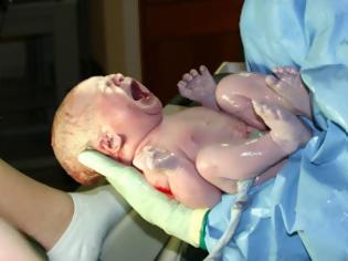 Φωτογραφία για Τα πρώτα συγκλονιστικά λεπτά της ζωής ενός μωρού