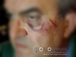 Φωτογραφία για Σπερχειάδα: Πλακώθηκαν στο ξύλο πρώην Αυτοδιοικητικός με αστυνομικό! [photo]