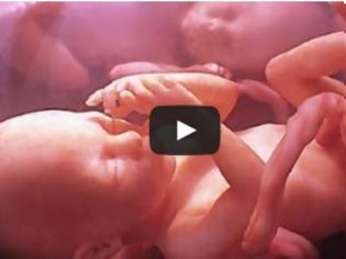 Φωτογραφία για ΔΕΙΤΕ δίδυμα μωρά να ΤΣΑΚΩΝΟΝΤΑΙ μέσα στον πλακούντα - Ενα βίντεο που όμοιο του δεν έχετε ξαναδεί...
