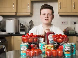 Φωτογραφία για Έφηβος εθισμένος στη ντομάτα υπνωτίστηκε για να φάει άλλο φαγητό!