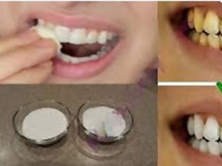 Φωτογραφία για Επιβεβαιωμένο - Λευκάνετε τα κίτρινα δόντια σας σε λιγότερο από 2 λεπτά... [video]