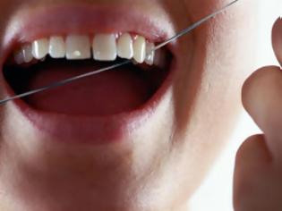 Φωτογραφία για Υπερεκτιμημένος ο ρόλος του οδοντικού νήματος - Δεν μειώνει την οδοντική πλάκα