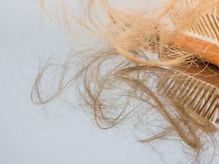 Φωτογραφία για Απώλεια μαλλιών: 3 φυσικές θεραπείες που πρέπει να δοκιμάσεις