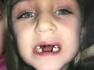 Φωτογραφία για Η μητέρα πήγε το κοριτσάκι στον οδοντίατρο να το εξετάσει… Όμως όταν άνοιξε την πόρτα του ιατρείου είδε…