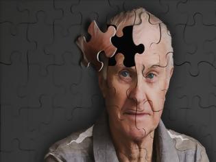 Φωτογραφία για Βρέθηκε φάρμακο που δίνει ελπίδες σε ασθενείς με Αλτσχάιμερ