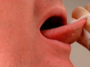 Φωτογραφία για ΠΡΟΣΟΧΗ! Καρκίνος του στόματος: Αυτά είναι τα αθόρυβα συμπτώματα