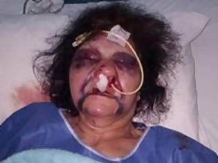 Φωτογραφία για Πέθανε η Κατερίνα Αθανασάκη - Τα φονικά χτυπήματα που σόκαραν τους χρήστες του facebook!