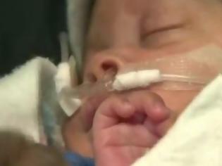 Φωτογραφία για Συγκλονιστικό βίντεο: Μωρό γεννήθηκε στον αμνιακό του σάκο! [photos]