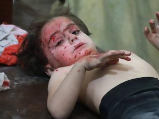 Φωτογραφία για ΠΡΟΣΟΧΗ! Εικόνες ΦΡΙΚΗΣ στη Συρία: Πρελούδιο θανάτου για χιλιάδες αθώα παιδιά