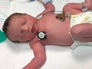Φωτογραφία για Ιατρικό θαύμα: Το μωρό που γεννήθηκε δύο φορές [photos]
