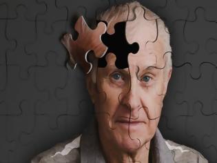 Φωτογραφία για Φάρμακο δίνει ελπίδες για την αντιμετώπιση του Αλτσχάιμερ
