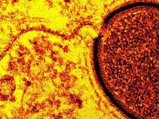 Φωτογραφία για Μυστηριώδεις ιοί που θα σας κρατήσουν… ξάγρυπνους