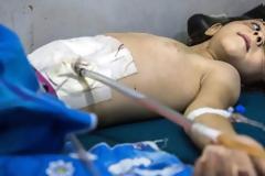 Χαλέπι, ώρα μηδέν: Το δράμα μιας πόλης υπό πολιορκία [Προσοχή: Σκληρές εικόνες]