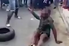 Έκαψαν ζωντανό μικρό αγόρι στο δρρόμο, το γιατί θα σας σοκάρει! [photos]