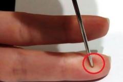 Δείτε ΤΙ πρέπει να κάνετε σε έναν άνθρωπο που παθαίνει ΕΓΚΕΦΑΛΙΚΟ επεισόδιο για να του σώσετε τη ζωή [video]