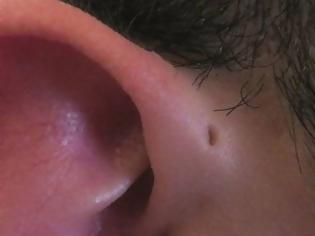 Φωτογραφία για Εσύ ξέρεις τι σημαίνει αυτή η τρύπα στα αυτιά μερικών ανθρώπων; Μόλις μάθετε θα ανατριχιάσετε...