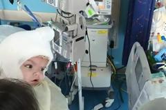 Σιαμαία που διαχωρίστηκαν, κοιτάχτηκαν για πρώτη φορά