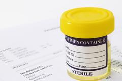 Γενική εξέταση ούρων - Πώς γίνεται σωστά και τι δείχνουν οι εξετάσεις;