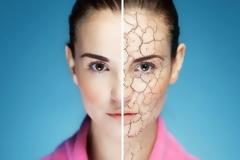 Ξηρό και ερεθισμένο δέρμα: Αντιμετώπιση με αυτές τις 5 τροφές