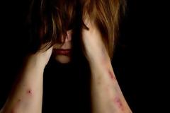 Πάτρα: Αυξάνονται με ανησυχητικούς ρυθμούς τα κρούσματα βίας κατά των γυναικών - 20 νέα περιστατικά κάθε μήνα