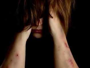 Φωτογραφία για Πάτρα: Αυξάνονται με ανησυχητικούς ρυθμούς τα κρούσματα βίας κατά των γυναικών - 20 νέα περιστατικά κάθε μήνα