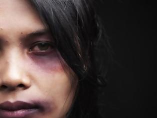 Φωτογραφία για Παγκόσμια Ημέρα για την εξάλειψη της βίας κατά των γυναικών