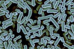 Τρομερό! Πέντε φορές πιο βρώμικο από το καπάκι της τουαλέτας είναι το...