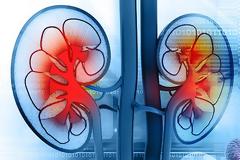 Χρόνια νεφρική νόσος και αιμοκάθαρση: Ποιες είναι οι επιπλοκές