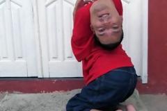 Ο άνθρωπος που γεννήθηκε με το κεφάλι ΑΝΑΠΟΔΑ - Η ΣΥΓΚΛΟΝΙΣΤΙΚΗ του Ιστορία... [photos+video]