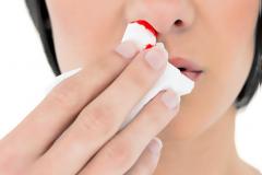 Αίμα από την μύτη: Πώς σταματάει – Τα λάθη που κάνετε χωρίς να το ξέρετε