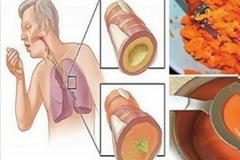 ΘΑΥΜΑΤΟΥΡΓΟ! Το έχετε στο σπίτι σας και είναι ικανό να θεραπεύσει τον βήχα