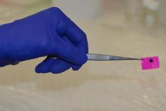 Έμφραγμα: Έφτιαξαν… τσιρότο για τις καρδιές που υπέστησαν βλάβη!