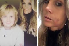 Μητέρα ζήλεψε τον γιο της και έκανε λακκάκια στα μάγουλα