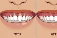 Βάλτε στο στόμα σας ΑΥΤΟ και θα δείτε τα ούλα σας να μεταμορφώνονται σε χρόνο-μηδέν!