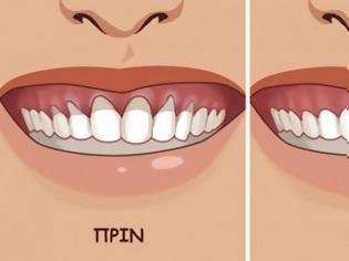Φωτογραφία για Βάλτε στο στόμα σας ΑΥΤΟ και θα δείτε τα ούλα σας να μεταμορφώνονται σε χρόνο-μηδέν!