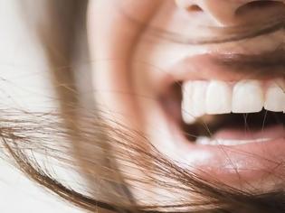 Φωτογραφία για 4 αποτελεσματικοί τρόποι για λευκότερα δόντια