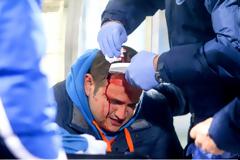 ΠΡΟΣΟΧΗ! ΣΚΛΗΡΕΣ ΕΙΚΟΝΕΣ! Αιμόφυρτος δημοσιογράφος από τα επεισόδια στο «Καυτανζόγλειο»!