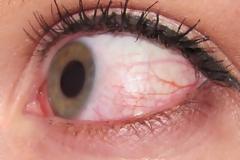 ΤΟ ΗΞΕΡΕΣ; Γιατί όταν είμαστε κουρασμένοι ΚΟΚΚΙΝΙΖΟΥΝ τα μάτια μας...;