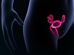 Φωτογραφία για Καρκίνος ωοθηκών: Τα ύπουλα σημάδια που πρέπει να γνωρίζει κάθε γυναίκα