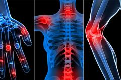 Εσείς τι γνωρίζετε για τις ρευματικές παθήσεις;