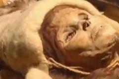 Ανακάλυψαν τον ιό της ευλογιάς σε παιδική μούμια