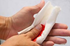 Κόψιμο στο δέρμα: Τα σωστά βήματα για να μην μολυνθεί