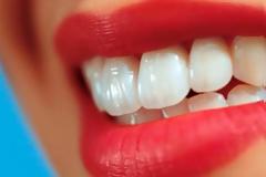 4 τροφές που λευκαίνουν τα δόντια φυσικά