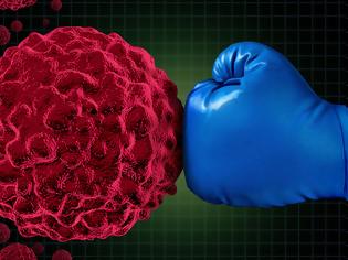 Φωτογραφία για Τρεις «αθόρυβες» μορφές καρκίνου: Πιθανότητες & πώς να προφυλαχθείτε