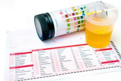 Πρωτεϊνουρία: Τι είναι και πώς συνδέεται με την άνοια