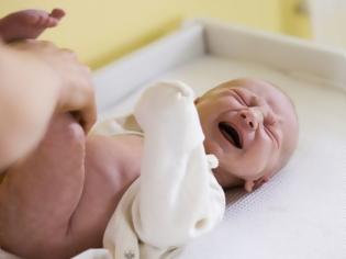 Φωτογραφία για 5 μικρά αλλά ενοχλητικά προβλήματα υγείας στα μωρά και πώς να τα ανακουφίσετε